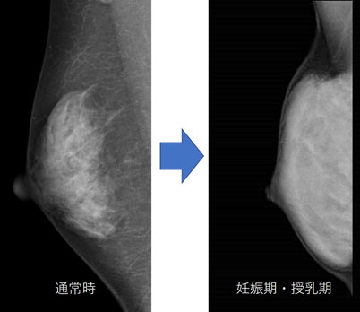 レントゲン画像 レントゲン画像