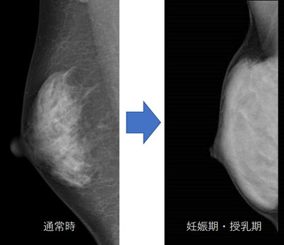 レントゲン画像